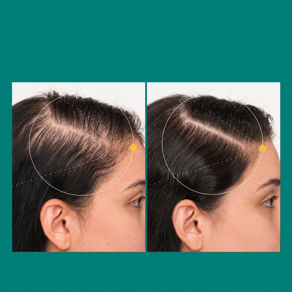 Nutrafol Postpartum